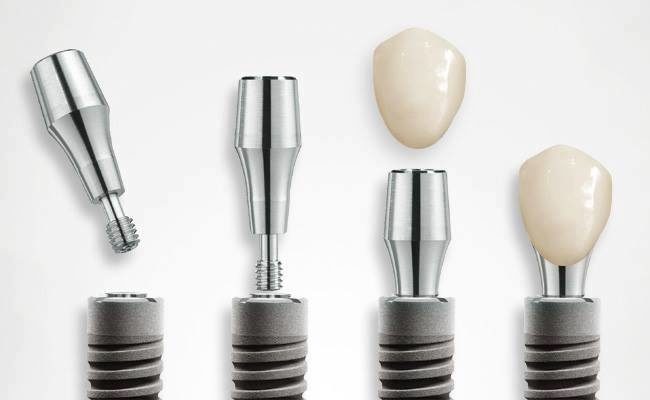 Dentale Implantologie